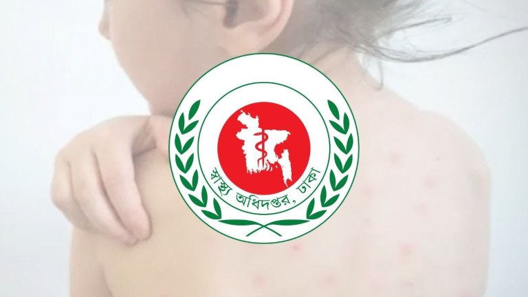 আজ হামের টিকা ক্যাম্পেইন আবার শুরু